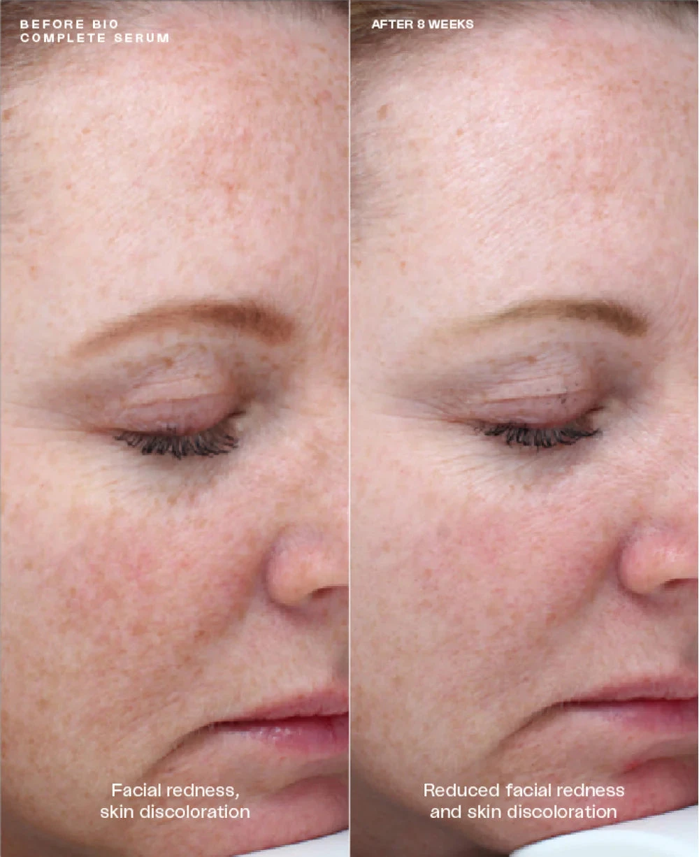 SENTE Bio Complete Serum - Image 5