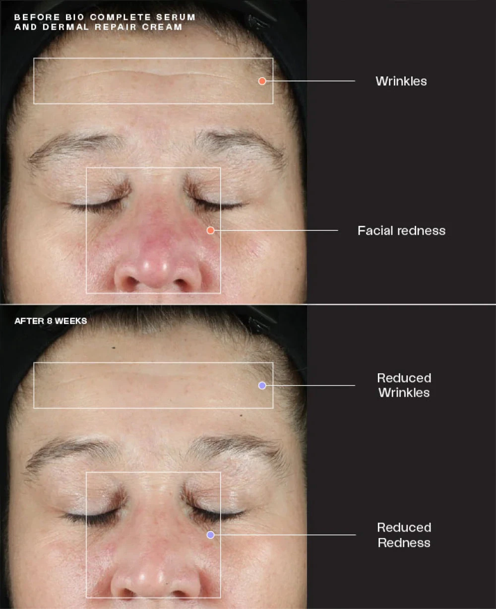 SENTE Bio Complete Serum - Image 6