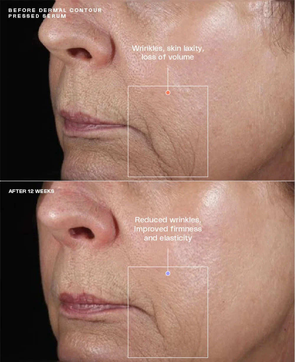 SENTE HydraFirm (Dermal Contour Pressed Serum) - Image 3