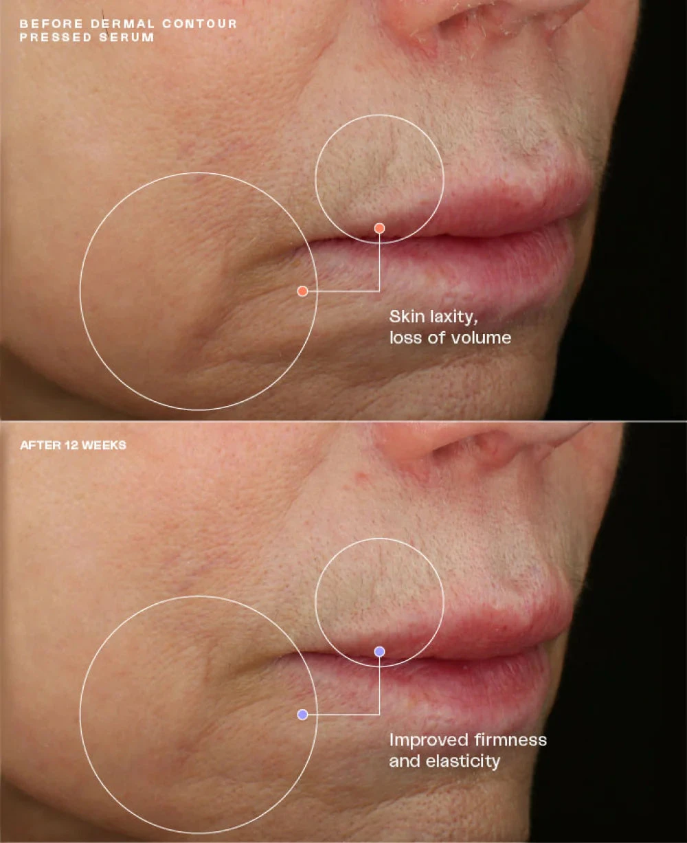 SENTE HydraFirm (Dermal Contour Pressed Serum) - Image 4