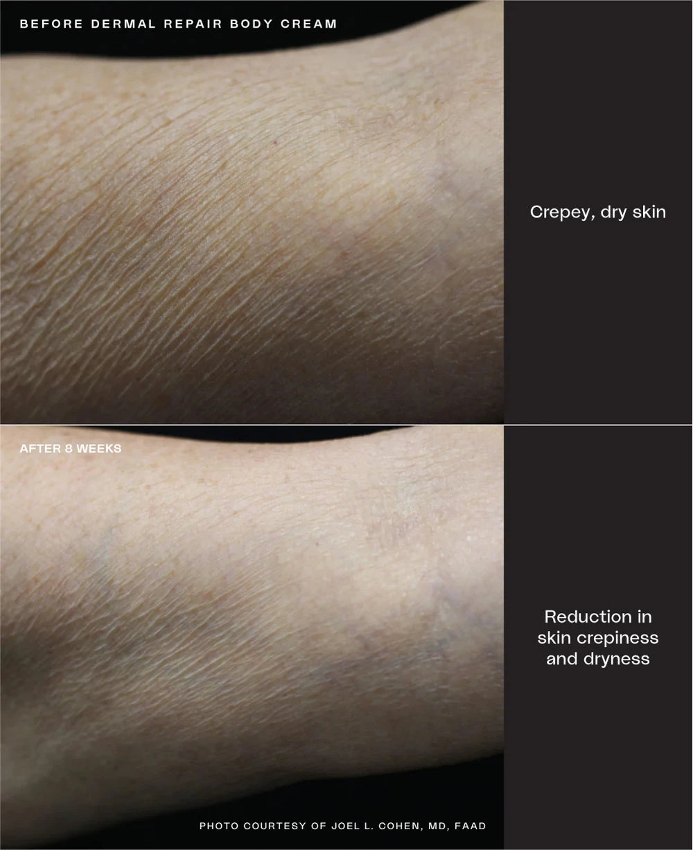 Sente Dermal Repair Body Cream - Image 3