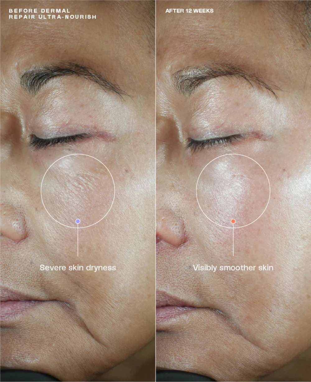 Sente Dermal Repair Duo* - Image 5