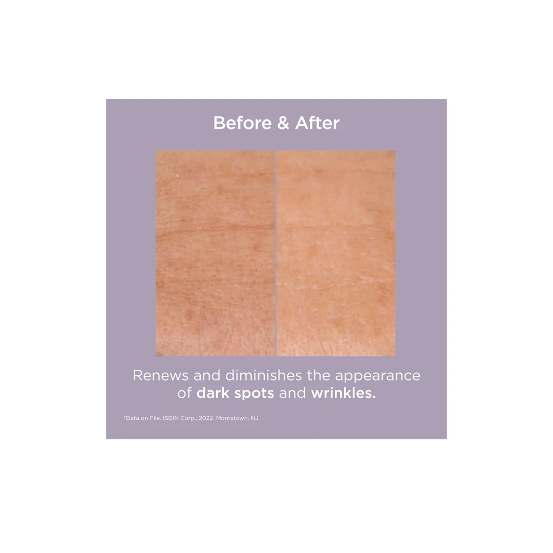 ISDIN ISDINCEUTICS Glicoisdin® 25 Intense - Image 2