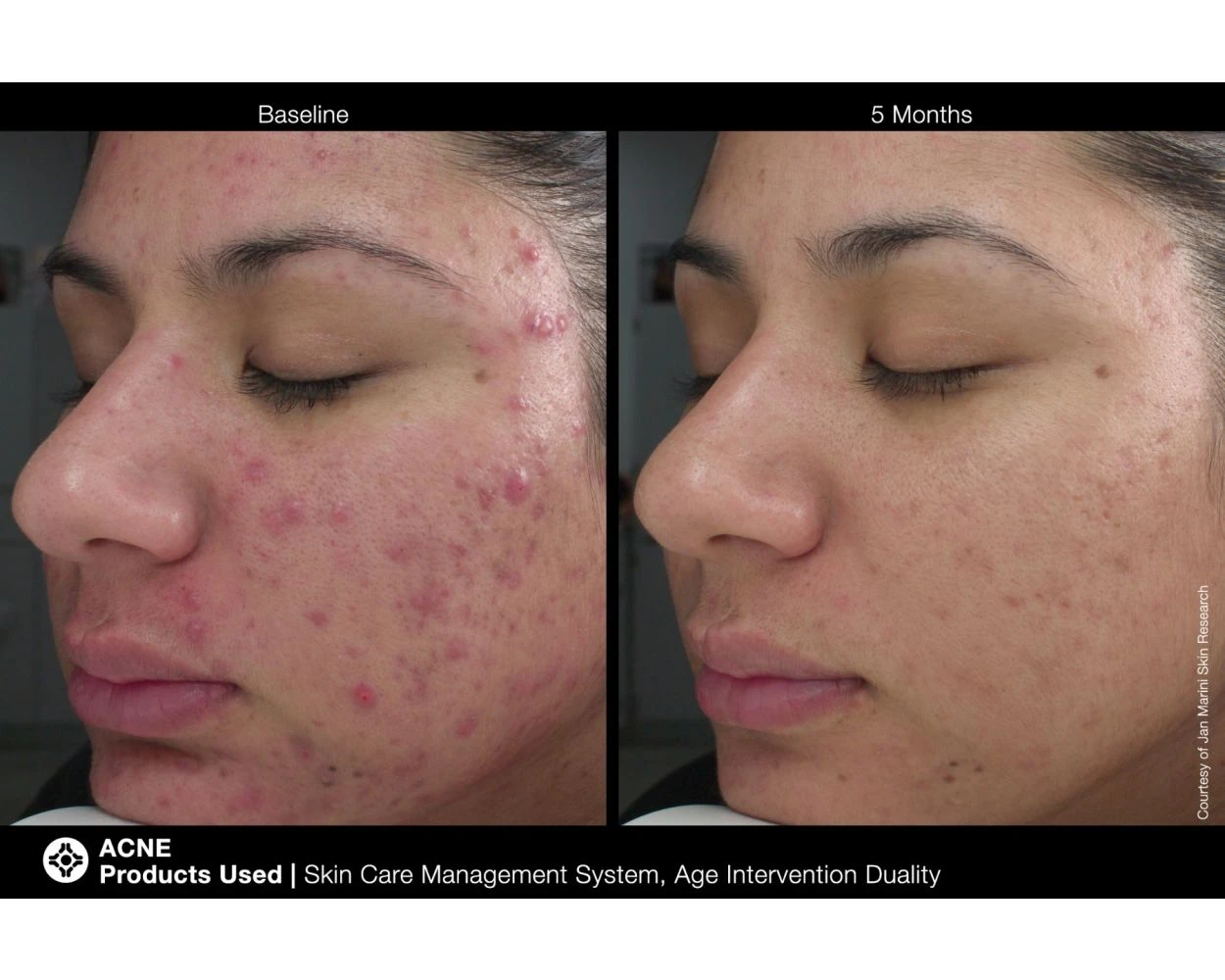 Jan Marini Age Intervention Duality - Image 5