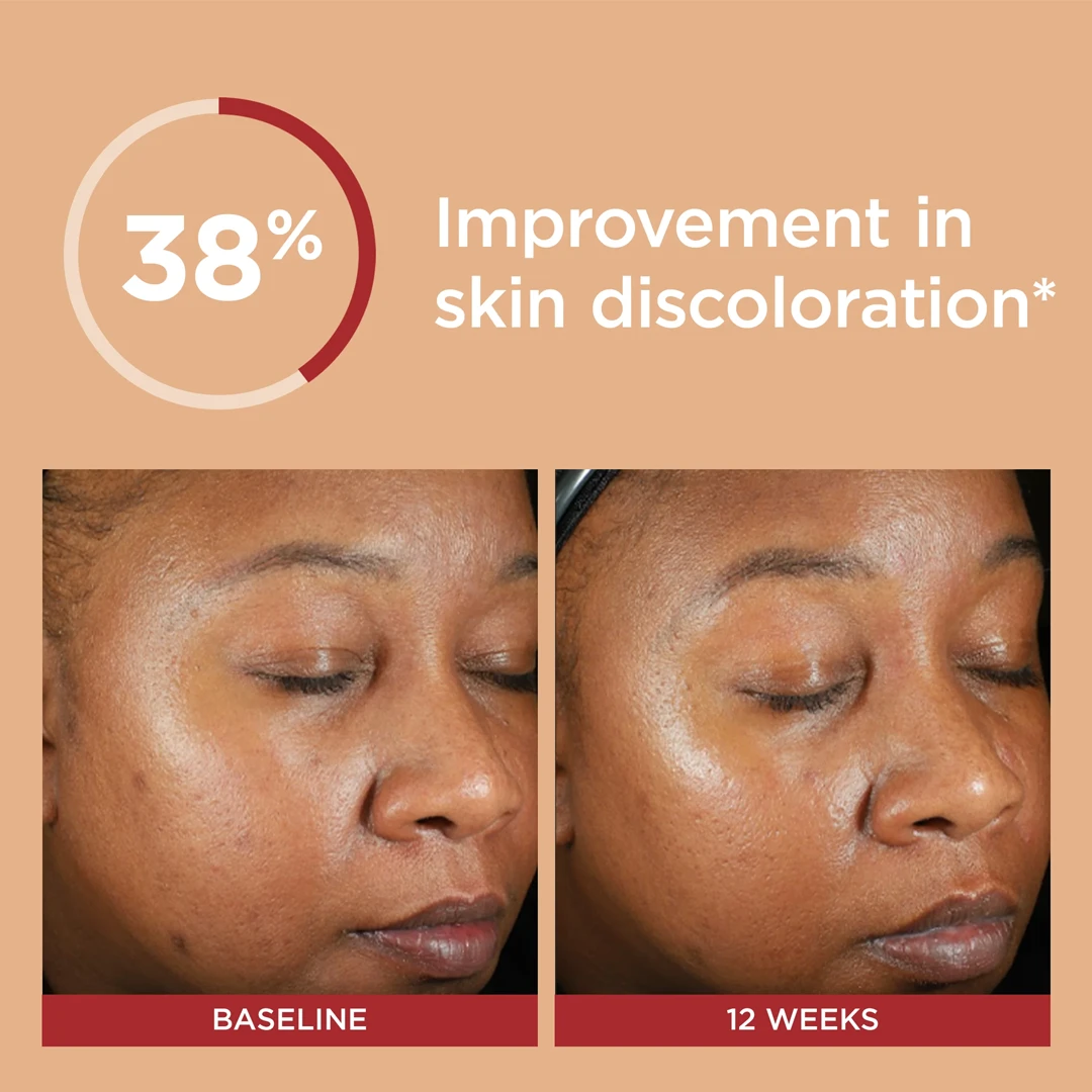 EltaMD UV Daily Deep Tinted Broad-Spectrum SPF 40 - Image 3