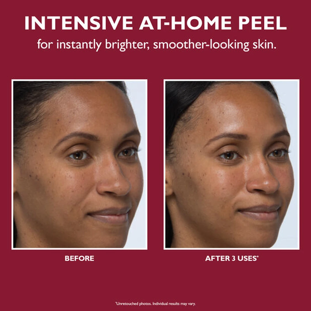 Peter Thomas Roth Even Smoother Instant Reveal Facial Peel (8-pack) - Image 2