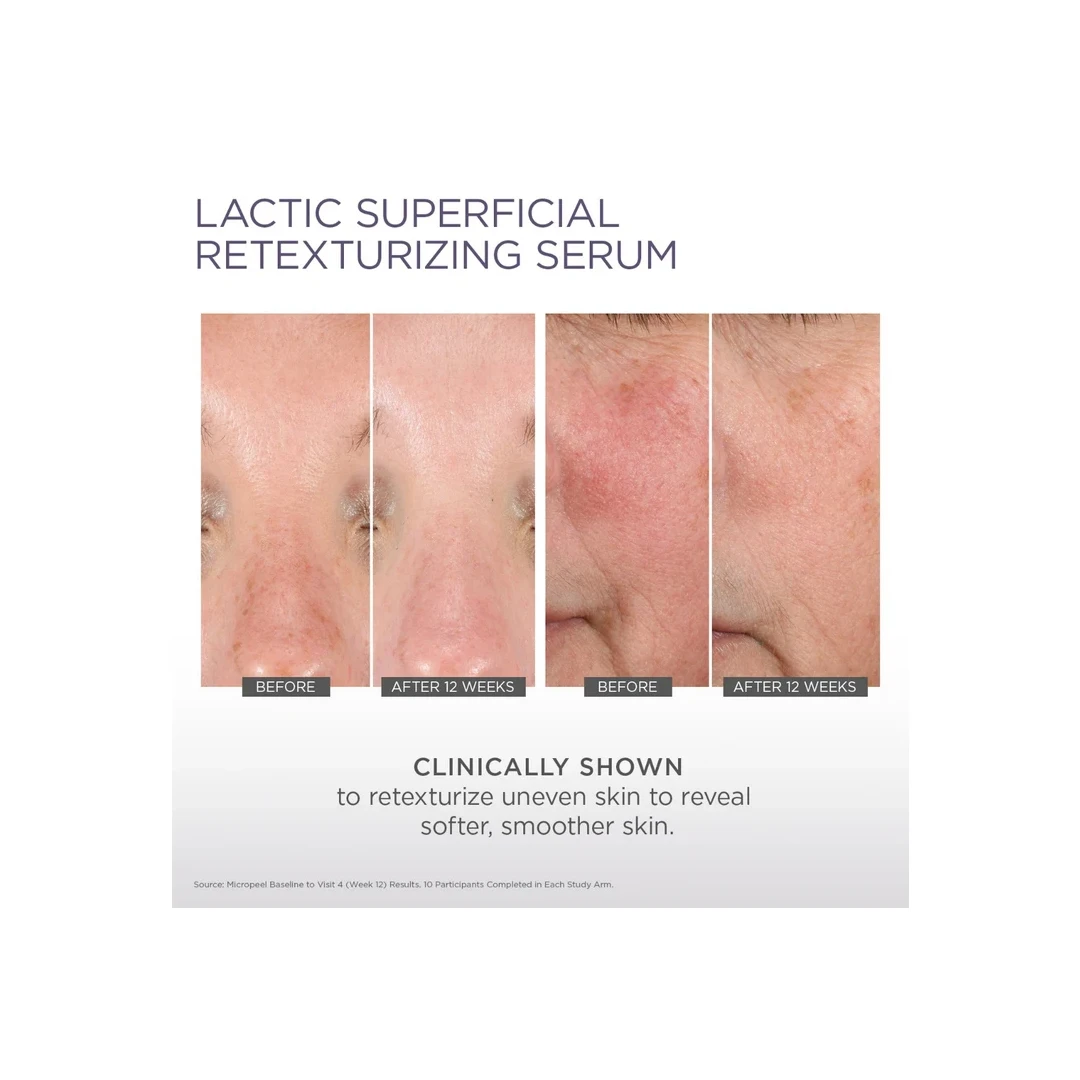 Glytone Lactic Superficial Retexturizing Serum - Image 2