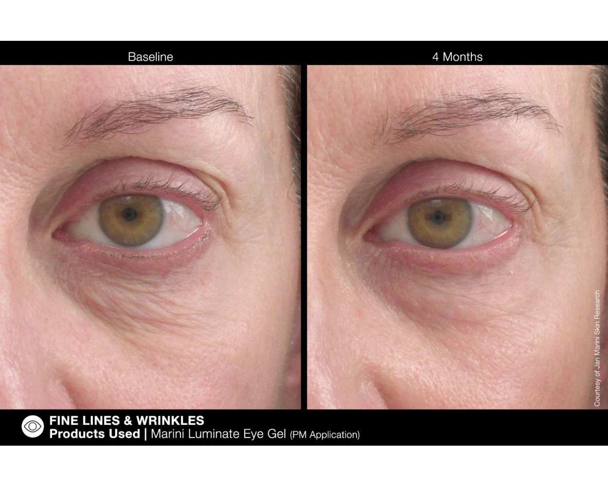 Jan Marini Luminate Eye Gel - Image 5