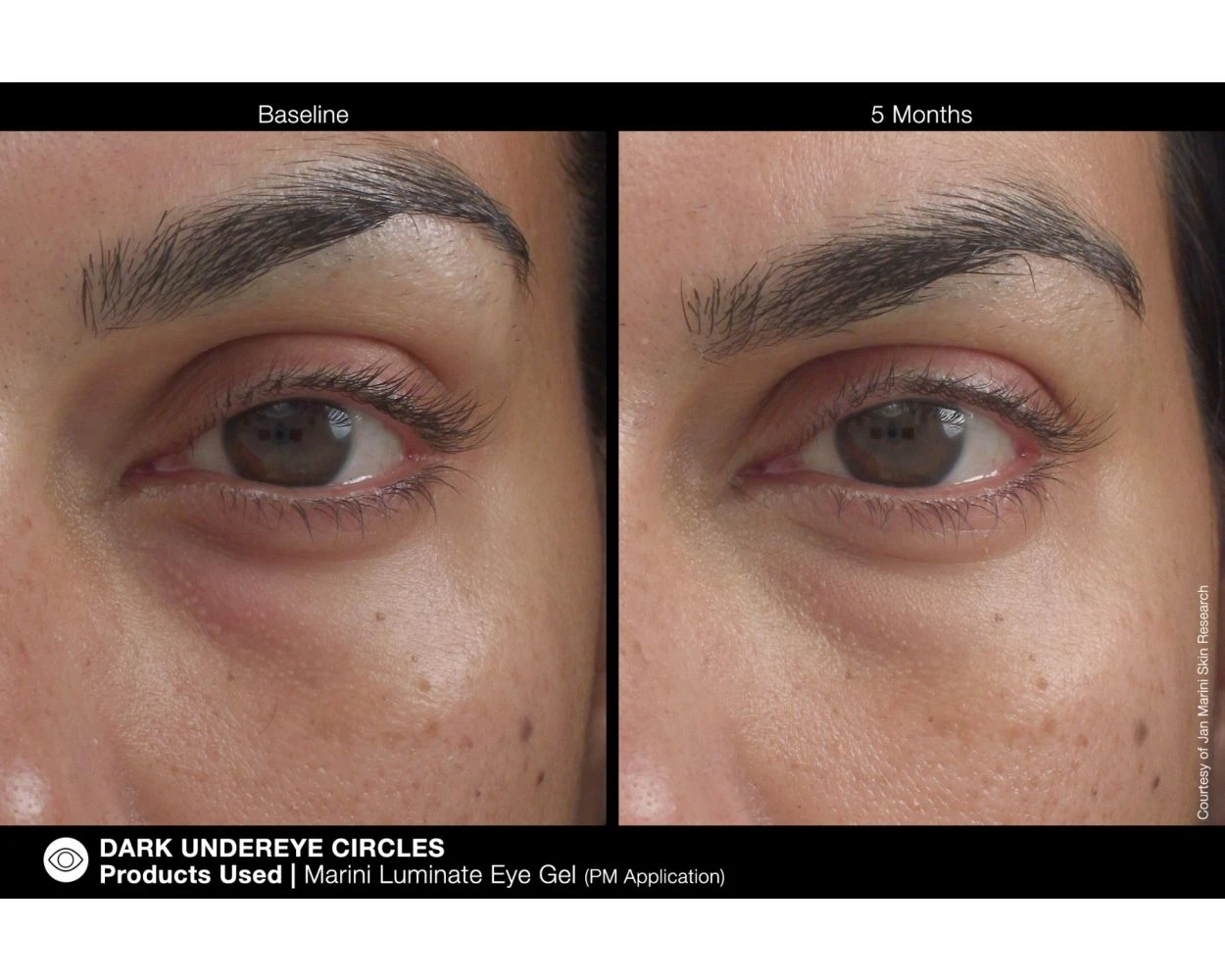 Jan Marini Luminate Eye Gel - Image 6