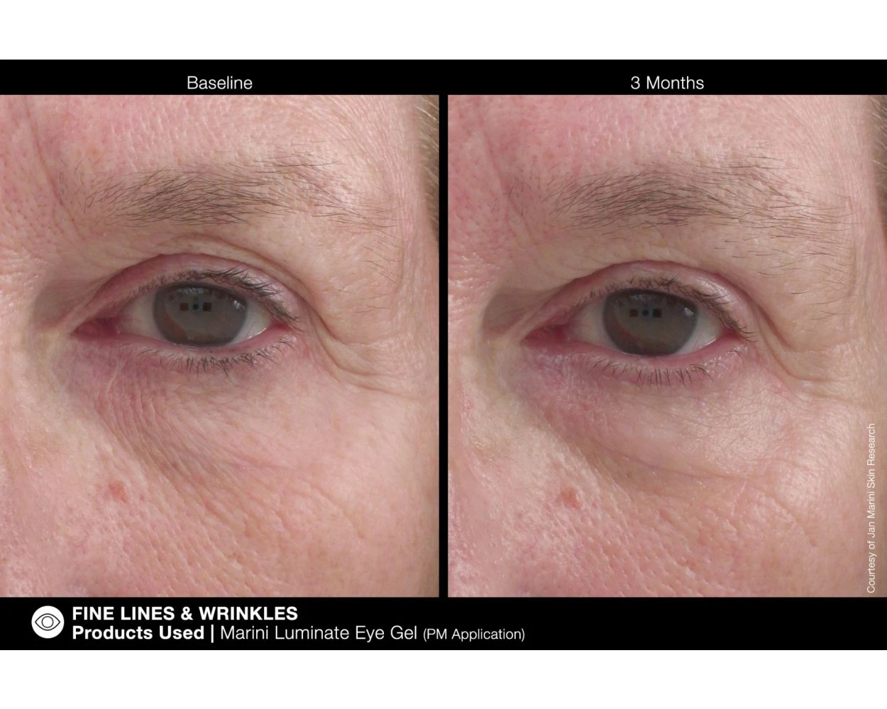 Jan Marini Luminate Eye Gel - Image 7