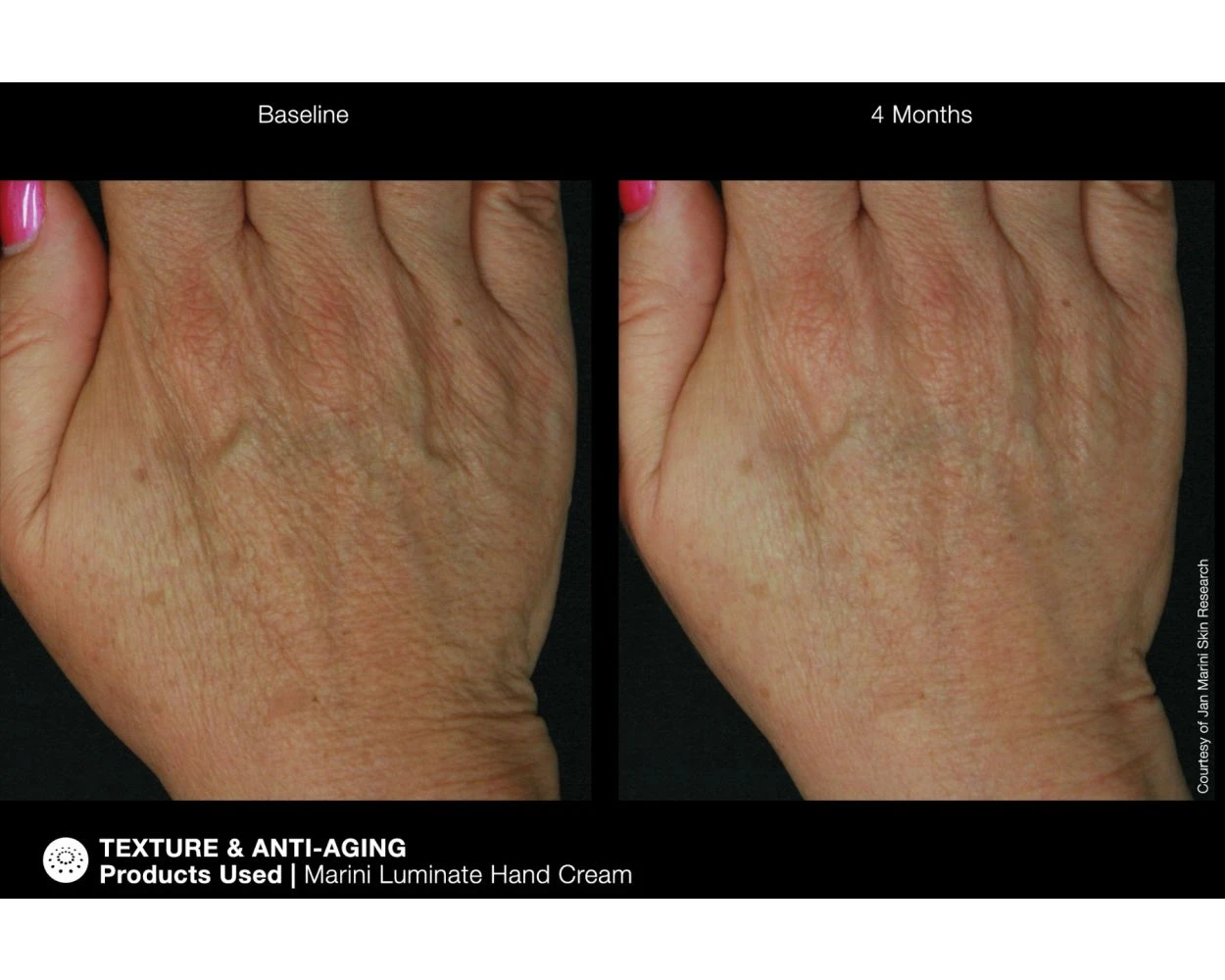 Jan Marini ReNu Corrective Hand Complex - Image 8