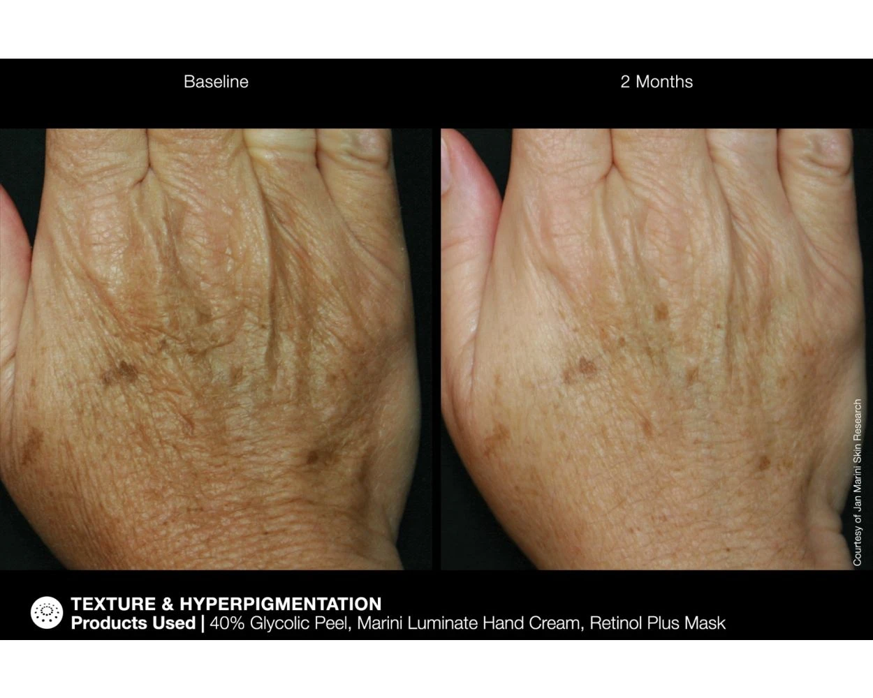 Jan Marini ReNu Corrective Hand Complex - Image 7