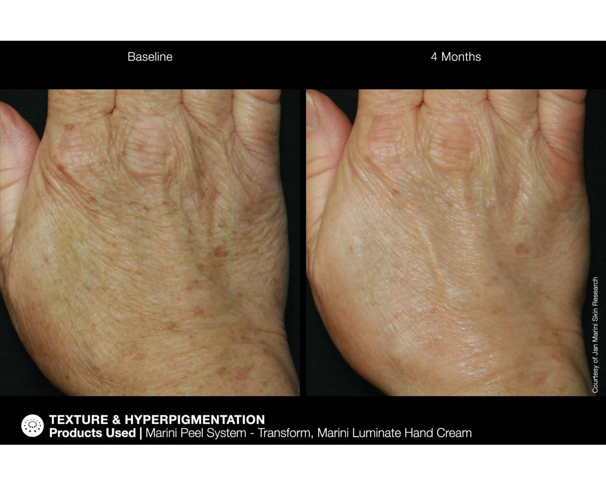 Jan Marini ReNu Corrective Hand Complex - Image 5