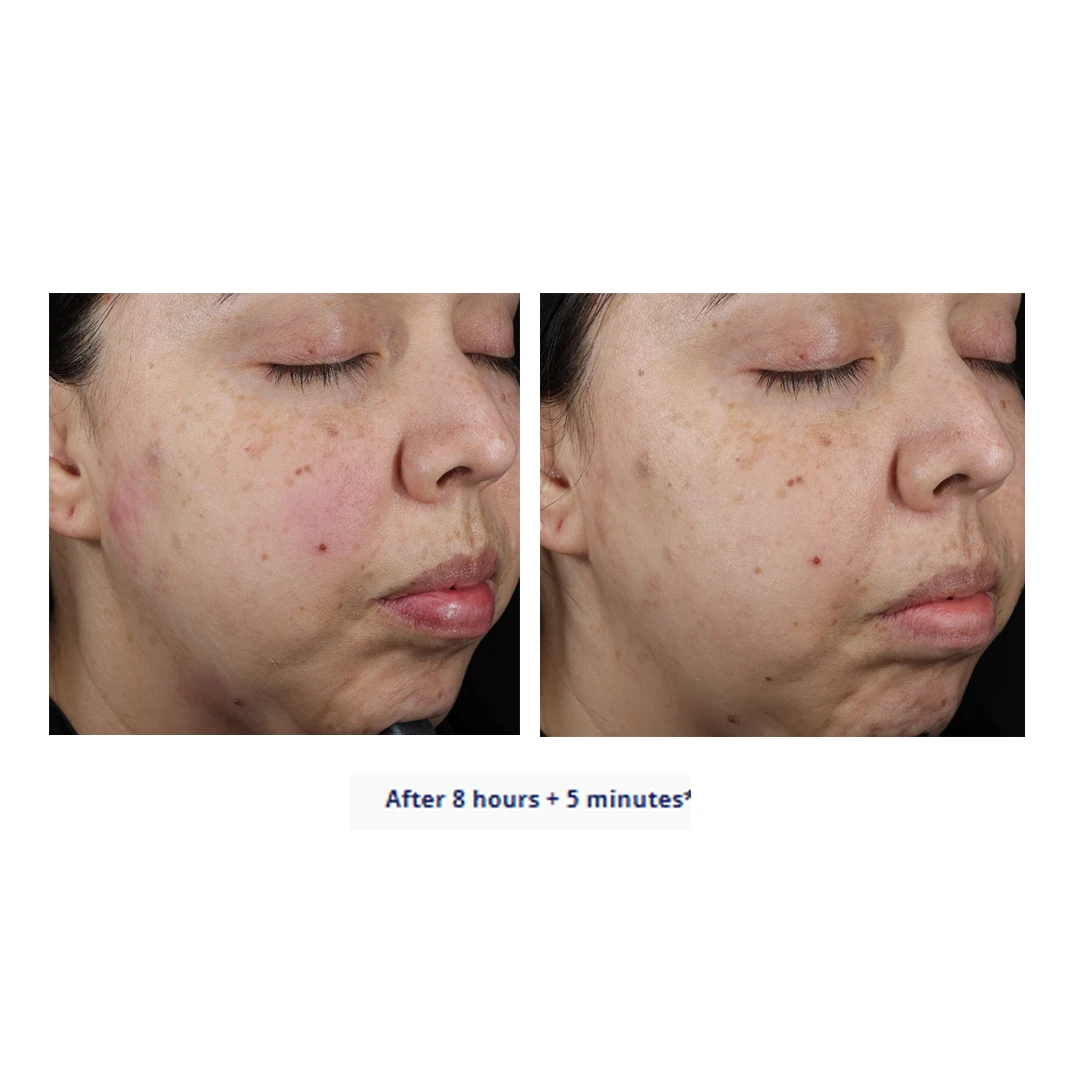 Suzan Obagi Moisture Restore - Image 3